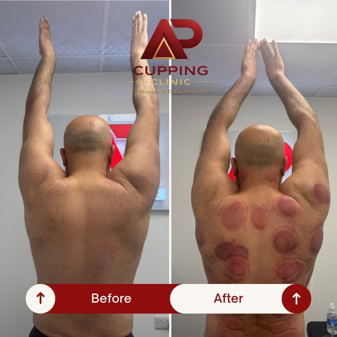 Before and after shoulder movement example