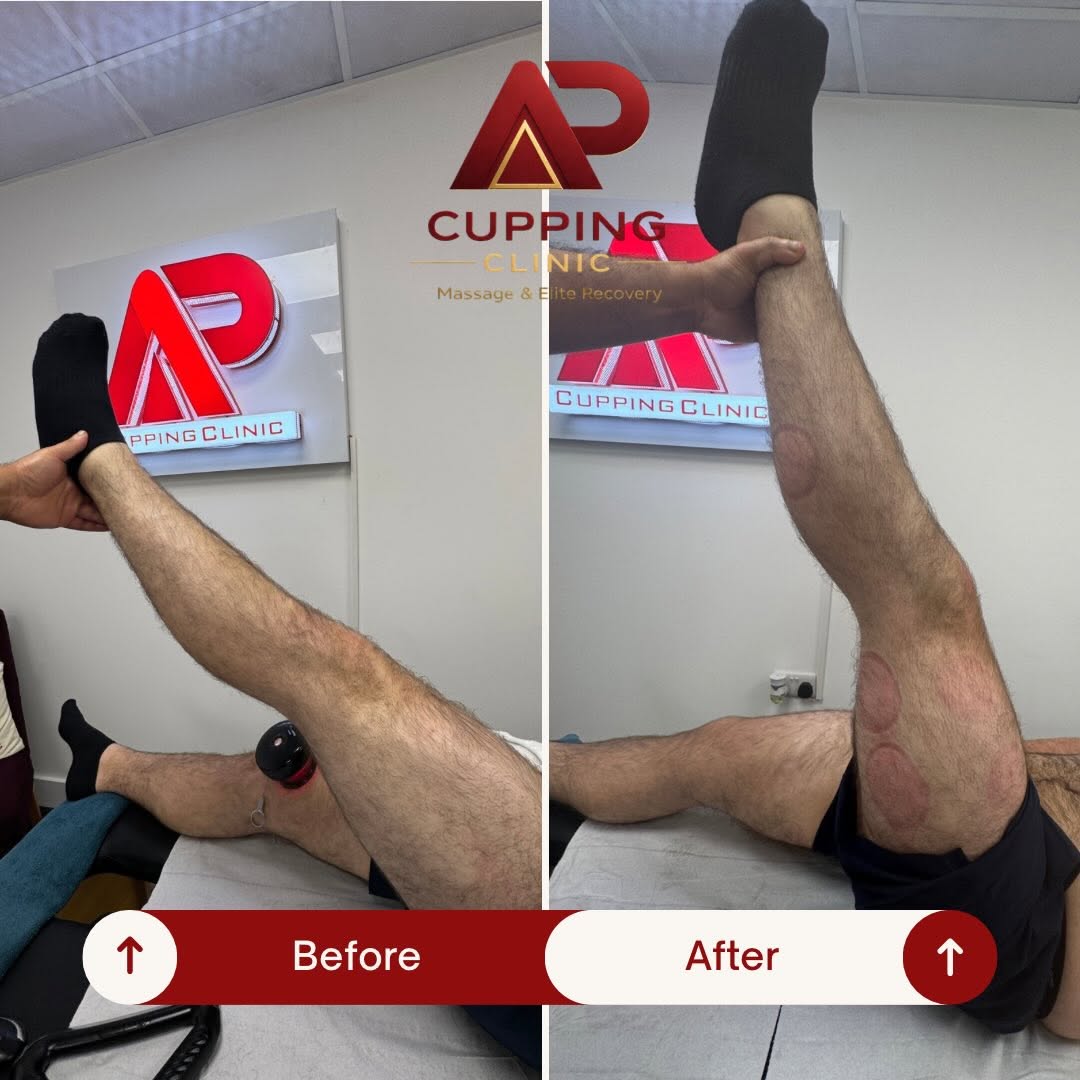 Before and after leg mobility example