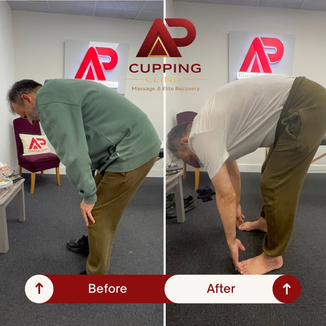 Before and after forward movement example