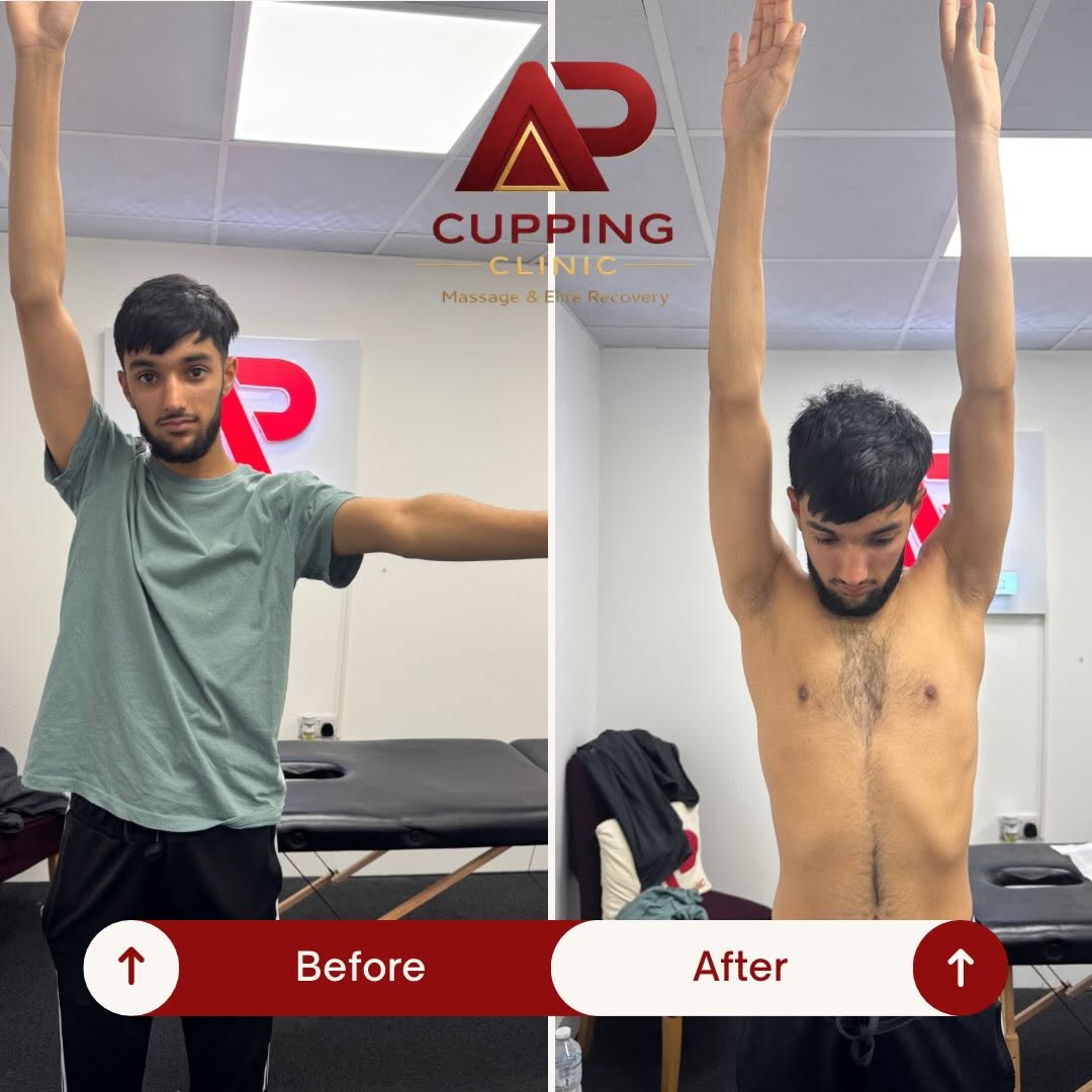 Before and after overhead shoulder movement example