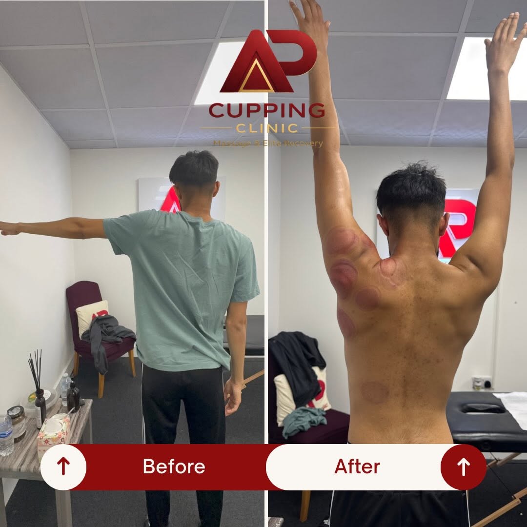 Before and after shoulder range example