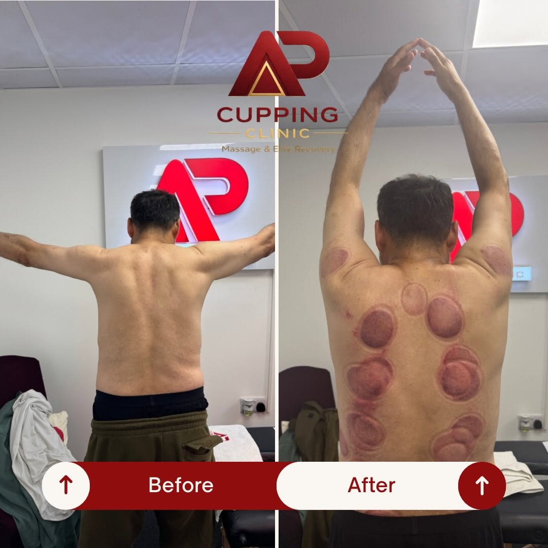 Before and after upper body movement example