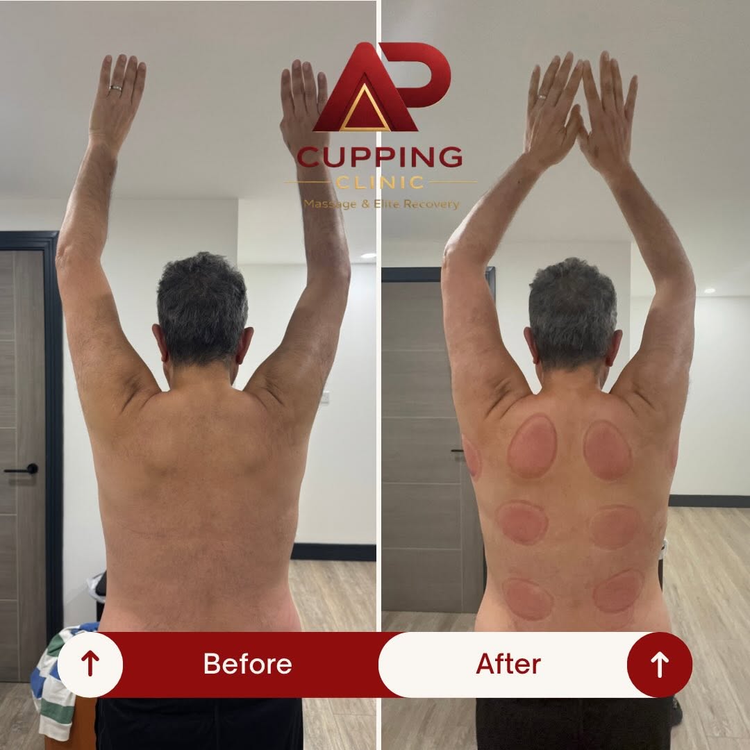Before and after overhead mobility example