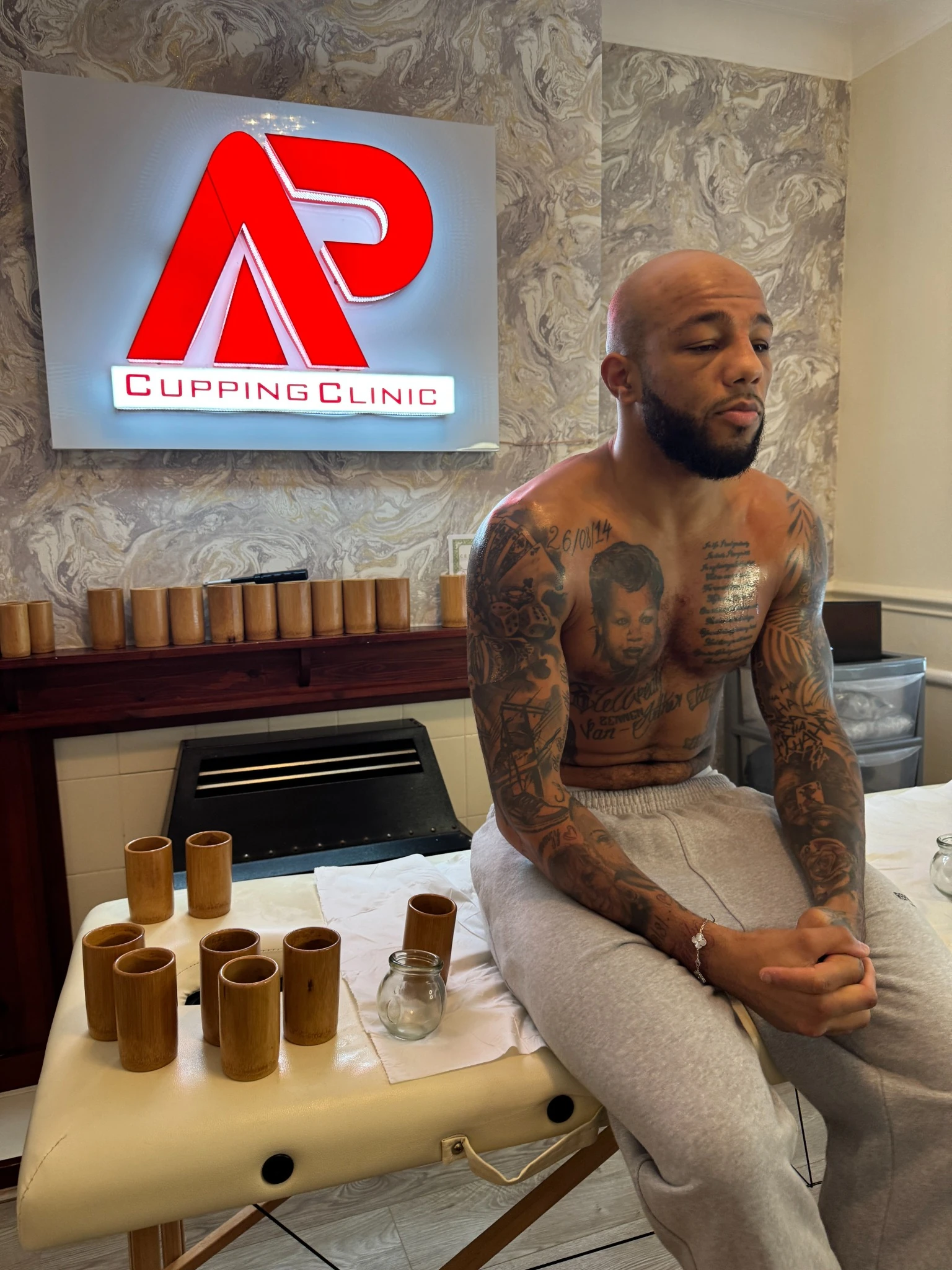 AP Cupping Clinic treatment client