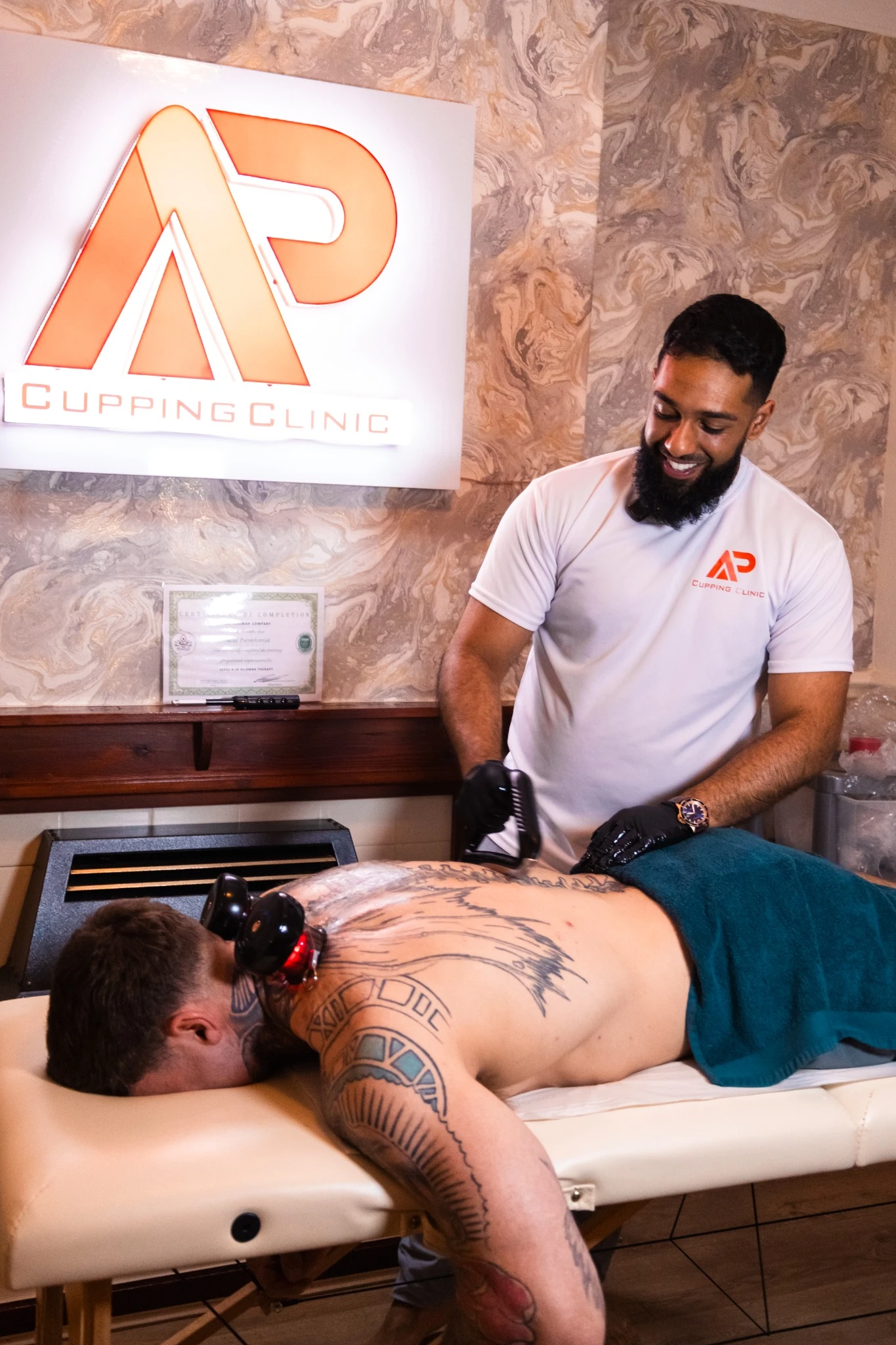Cupping and Hijama treatment